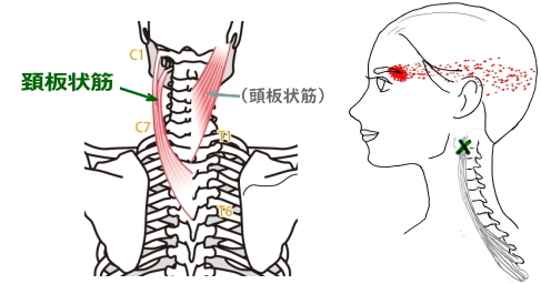 目の奥の痛い頭痛 目の奥の痛い頭痛