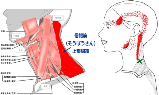 こめかみ の 下 の 骨 押す と 痛い