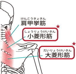 菱形筋の痛みと肩コリ 菱形筋の痛みと肩コリ