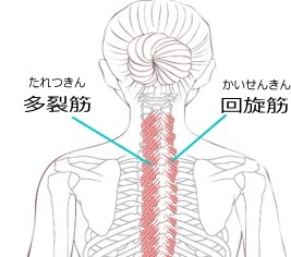多裂筋 回旋筋の肩こり 多裂筋 回旋筋の肩こり