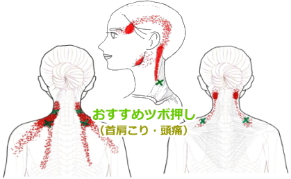 僧帽筋上部のツボ押し