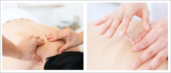 筋肉の状態を見極めながら行う鍼灸アロマ施術の様子