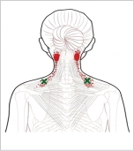 僧帽筋上部線維 トリガーポイント 肩こり 首の付け根