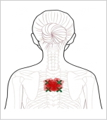 多裂回旋筋 トリガーポイント 背中の深部痛