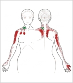 斜角筋 トリガーポイント 肩こりと腕の重だるさ